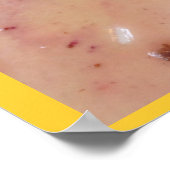 Vruchten en gisten poster (Hoek)