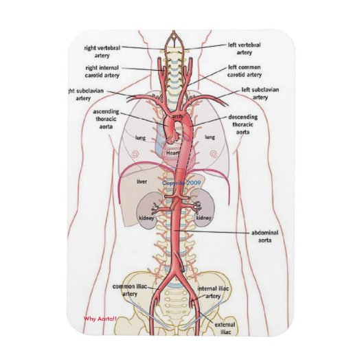 WAAROM AORTA!! Magneten (Verticaal)
