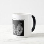 Wanneer radiologen selfies nemen magische mok (Voorkant rechts)