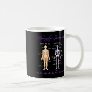 Wat zie je wat ik voel Skeleton Fibromyalgie Awa Koffiemok