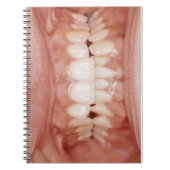 Weird Unusual Gory Teeth Gums Foto Notitieboek (Voorkant)