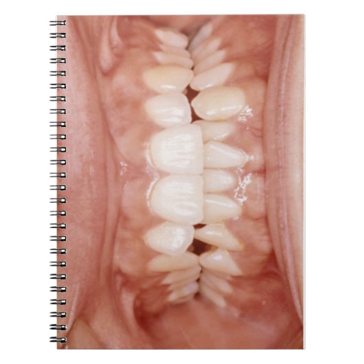 Weird Unusual Gory Teeth Gums Foto Notitieboek (Voorkant)