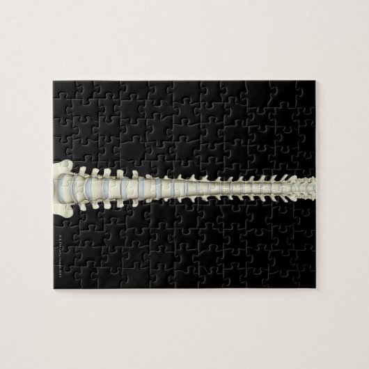 wervelkolom 2 legpuzzel (Horizontaal)