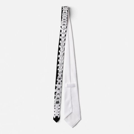 Wervelkolom orthopedische chirurgie stropdas (Achterkant)