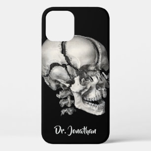  Wetenschap Menselijke Anatomie, Antiek schedel Case-Mate iPhone Case