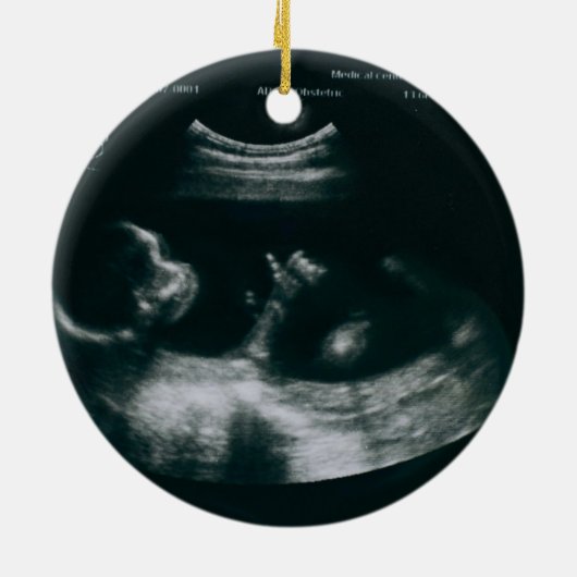 Whimsical Grandparents Pregnancy Announcement Keramisch Ornament (Achterkant)