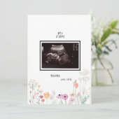 Wildbloemen Ultrasound Foto: grappig Bedankkaart (Staand voorkant)