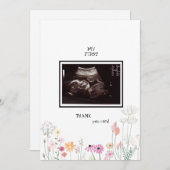 Wildbloemen Ultrasound Foto: grappig Bedankkaart (Voorkant / Achterkant)