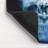 X-head Muismat (Hoek)