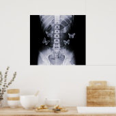 X-Ray Anticipatory Conceptual Butterflies Poster (Keuken)