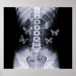 X-Ray Anticipatory Conceptual Butterflies Poster