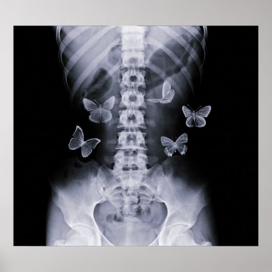 X-Ray Anticipatory Conceptual Butterflies Poster (Voorkant)