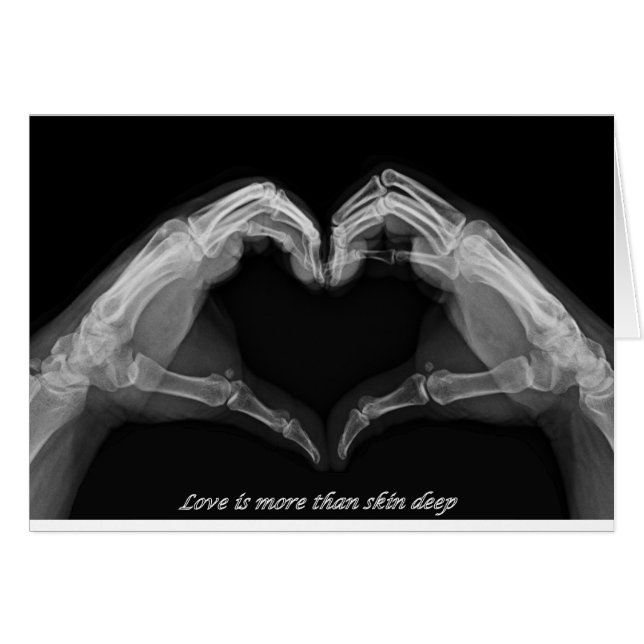 X-Ray Art (Voorkant Horizontaal)