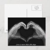 X-Ray Art Briefkaart (Voorkant / Achterkant)