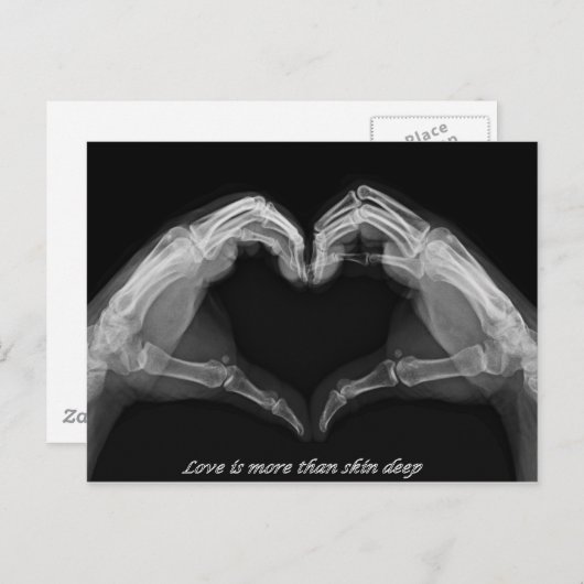 X-Ray Art Briefkaart (Voorkant / Achterkant)