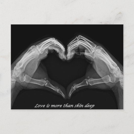 X-Ray Art Briefkaart (Voorkant)