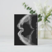 X-Ray Art Briefkaart (Staand voorkant)