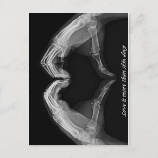 X-Ray Art Briefkaart