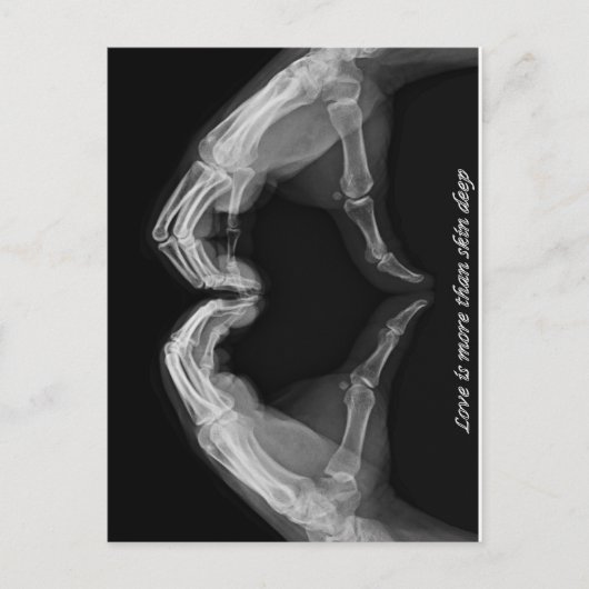 X-Ray Art Briefkaart (Voorkant)