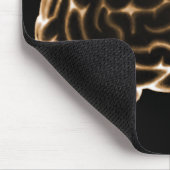 X-RAY BRAIN SIDE UITZICHT SINAASAPPEL MUISMAT (Hoek)