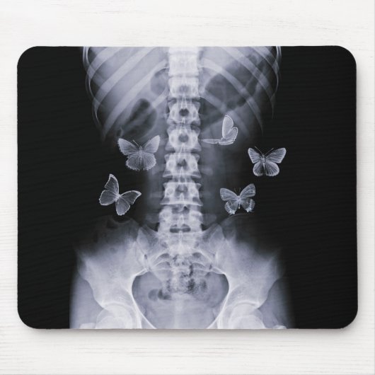 X-Ray Conceptual Butterflies Mousepad Muismat (Voorkant)