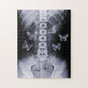 X-Ray Conceptual Butterflies Puzzle Legpuzzel
