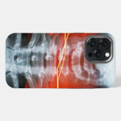 X-Ray Digitale Kunstwerk Hoesje iPhone Hoesje (Achterkant horizontaal)