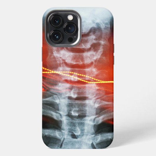 X-Ray Digitale Kunstwerk Hoesje iPhone Hoesje (Achterkant)