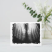 X-Ray Feet Human Skeleton Botten zwart-wit Briefkaart (Staand voorkant)