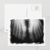 X-Ray Feet Human Skeleton Botten zwart-wit Briefkaart (Voorkant / Achterkant)
