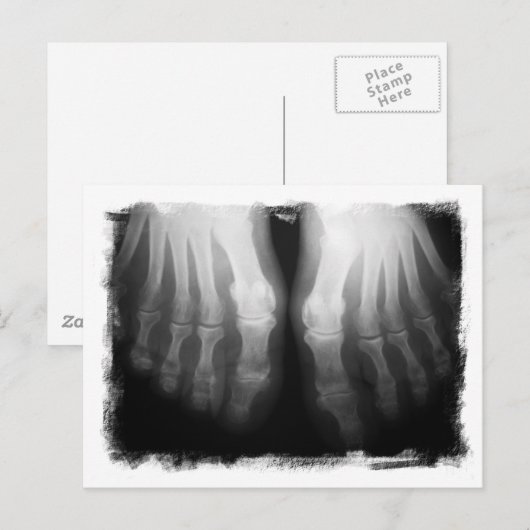 X-Ray Feet Human Skeleton Botten zwart-wit Briefkaart (Voorkant / Achterkant)