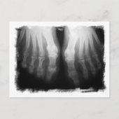 X-Ray Feet Human Skeleton Botten zwart-wit Briefkaart (Voorkant)