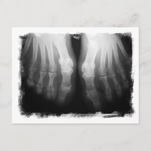 X-Ray Feet Human Skeleton Botten zwart-wit Briefkaart (Voorkant)