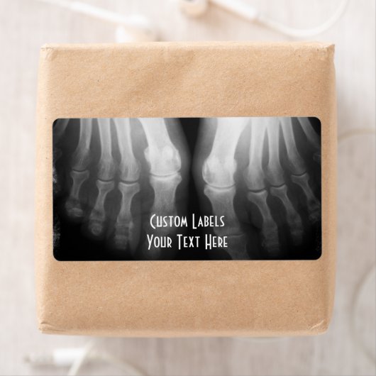 X-Ray Feet Human Skeleton Botten zwart-wit Etiket (Insitu)