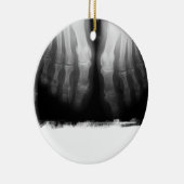 X-Ray Feet Human Skeleton Botten zwart-wit Keramisch Ornament (Rechts)