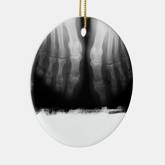 X-Ray Feet Human Skeleton Botten zwart-wit Keramisch Ornament (Rechts)