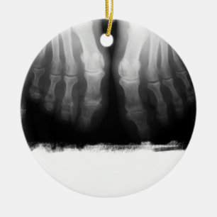 X-Ray Feet Human Skeleton Botten zwart-wit Keramisch Ornament