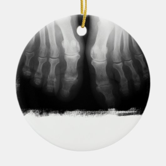 X-Ray Feet Human Skeleton Botten zwart-wit Keramisch Ornament (Voorkant)