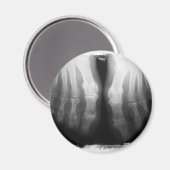X-Ray Feet Human Skeleton Botten zwart-wit Magneet (Voorkant / Achterkant)