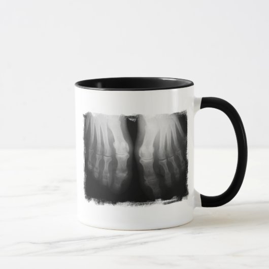 X-Ray Feet Human Skeleton Botten zwart-wit Mok (Rechts)
