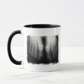 X-Ray Feet Human Skeleton Botten zwart-wit Mok (Links)