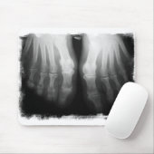 X-Ray Feet Human Skeleton Botten zwart-wit Muismat (Met muis)