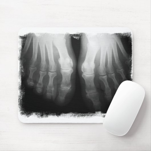 X-Ray Feet Human Skeleton Botten zwart-wit Muismat (Met muis)