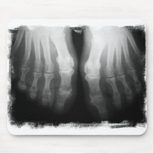 X-Ray Feet Human Skeleton Botten zwart-wit Muismat
