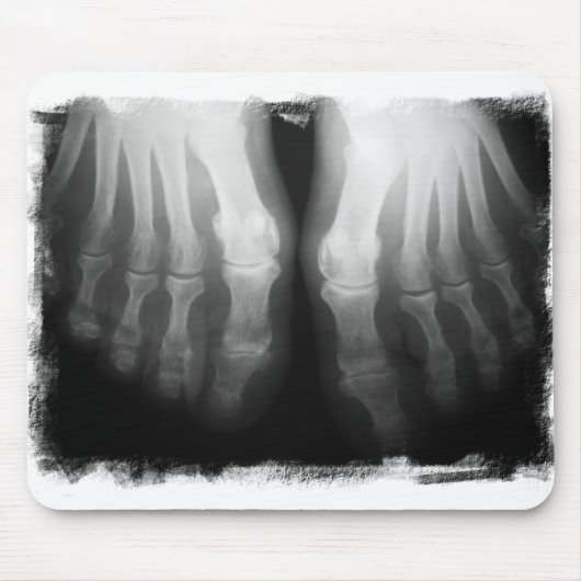 X-Ray Feet Human Skeleton Botten zwart-wit Muismat (Voorkant)