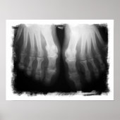 X-Ray Feet Human Skeleton Botten zwart-wit Poster (Voorkant)