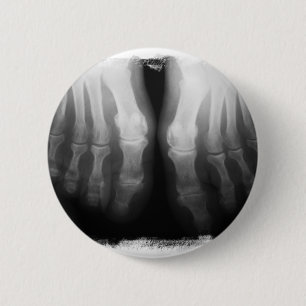 X-Ray Feet Human Skeleton Botten zwart-wit Ronde Button 5,7 Cm