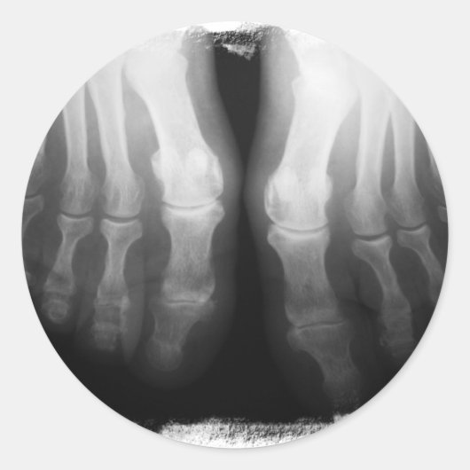 X-Ray Feet Human Skeleton Botten zwart-wit Ronde Sticker (Voorkant)