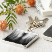 X-Ray Feet Human Skeleton Botten zwart-wit Sleutelhanger (Zijkant)