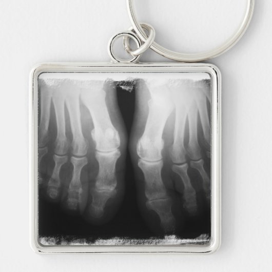 X-Ray Feet Human Skeleton Botten zwart-wit Sleutelhanger (Voorkant)